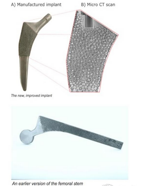 MicGill大學(xué)推出接近天然骨的多孔3D打印骨骼植入物國(guó)外新聞3D虎