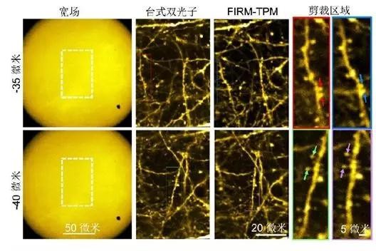 超快光纖激光助力微型雙光子顯微成像系統(tǒng)研究 超快光纖激光助力微型雙光子顯微成像系統(tǒng)研究